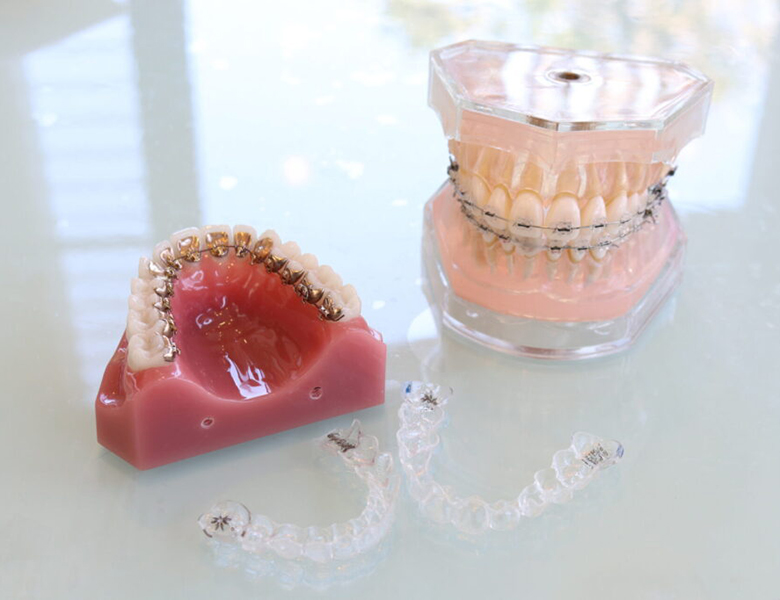 西馬込（大田区）の歯医者、なおい歯科クリニックの矯正治療