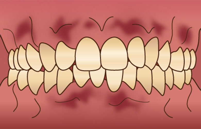 西馬込（大田区）の歯医者、なおい歯科クリニックのホワイトニング
