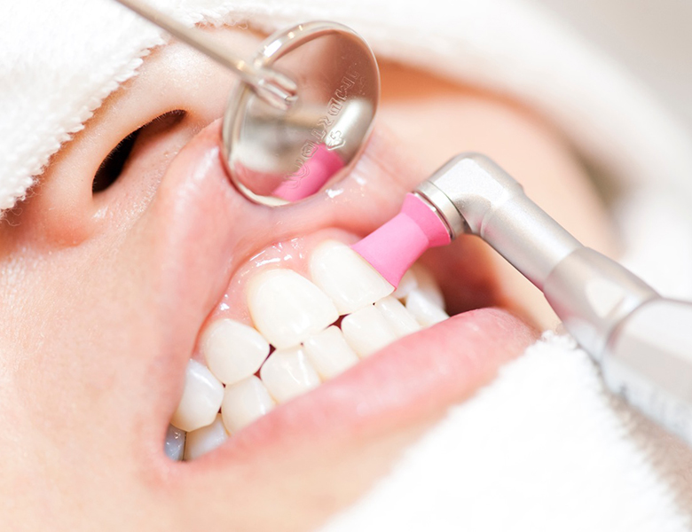 西馬込（大田区）の歯医者、なおい歯科クリニックの予防歯科